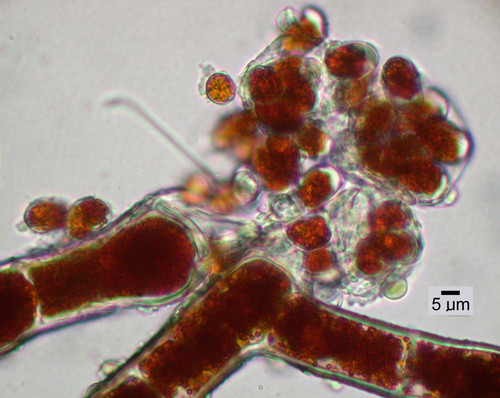 Trentepohlia (alga) species - Sporangia